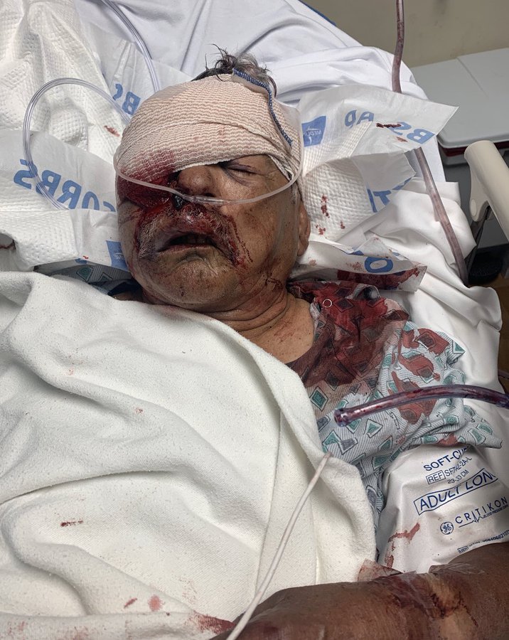 Grandpa Roberto Flores Lopez Robbed